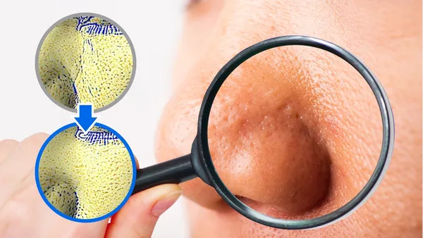 여름모공 리커버리 극복패키지